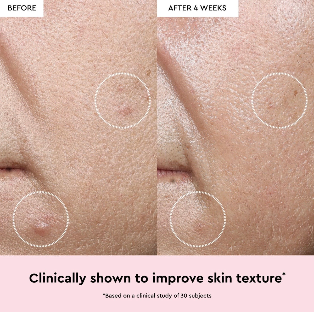 GLOW RECIPE Watermelon Glow Niacinamide Dew Drops